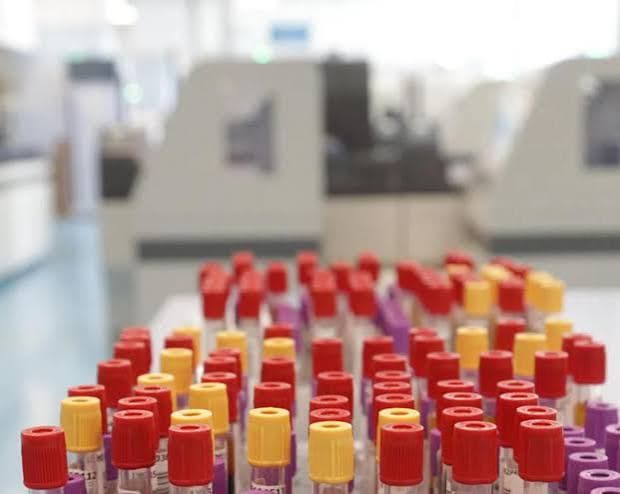 A Francoforte, i casi di malaria salgono a otto: tre morti nell'area aeroportuale